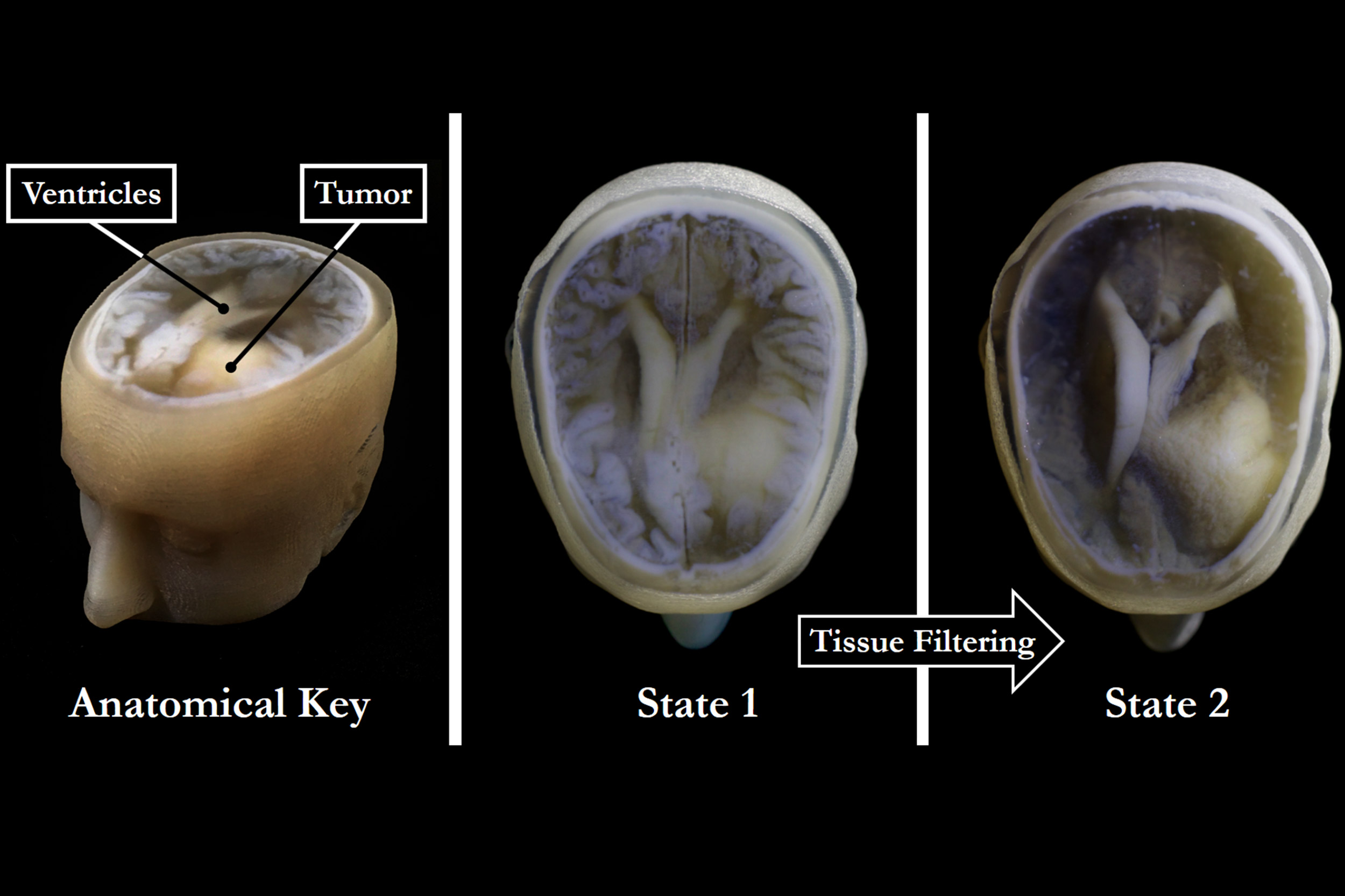 Brain model