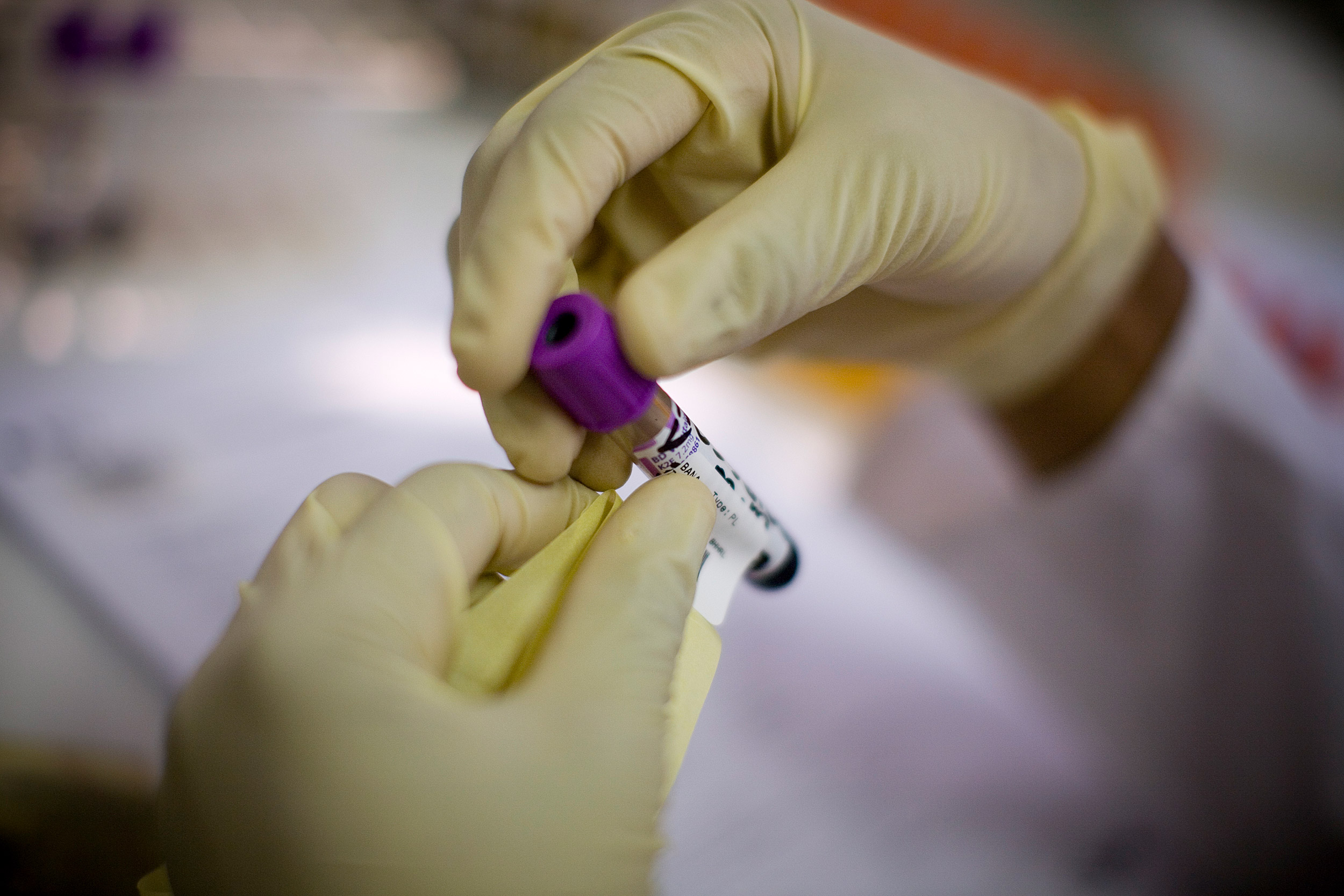 Gloved hands holding blood sample.