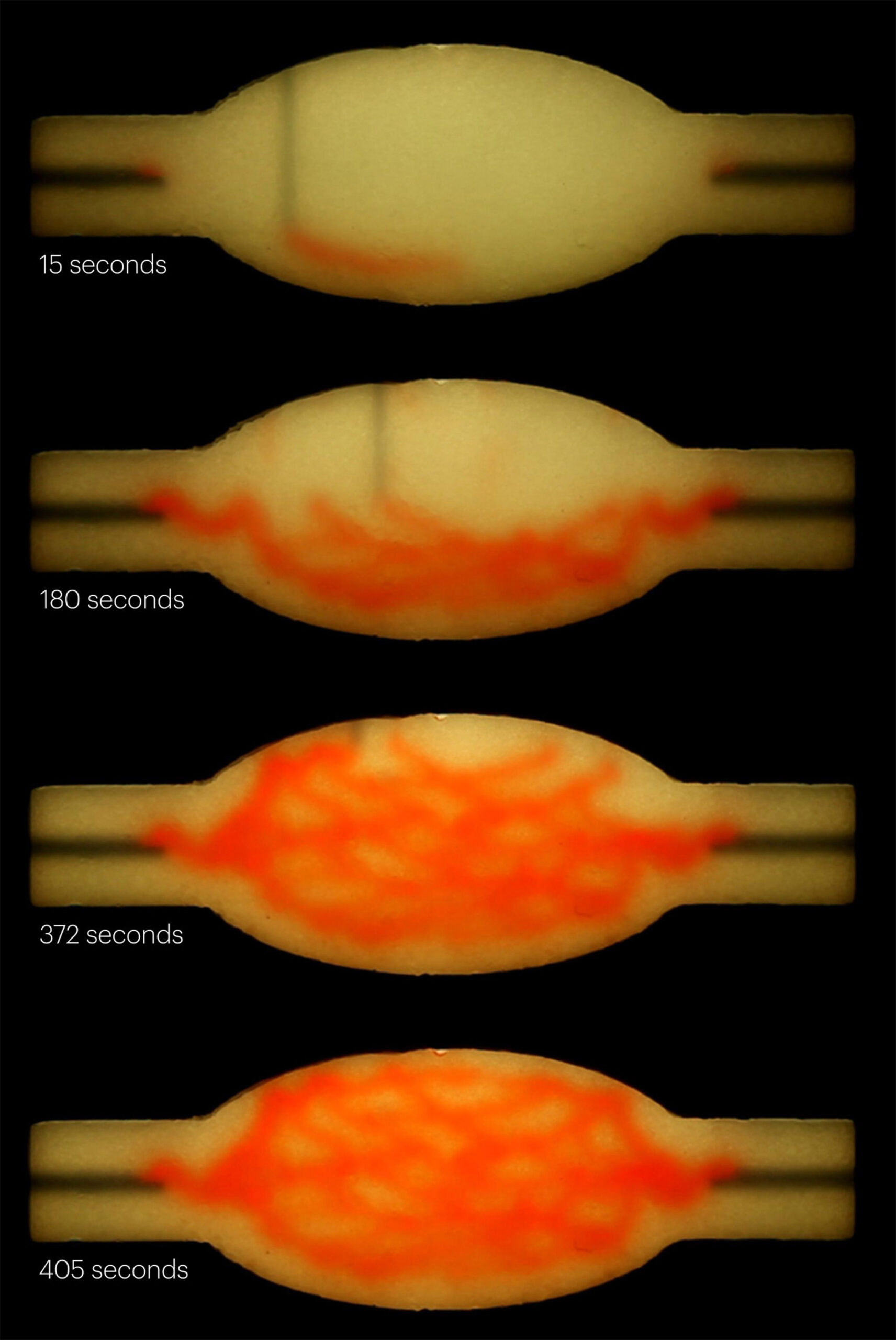 This image sequence shows a pervasive, branching network of vascular channels (