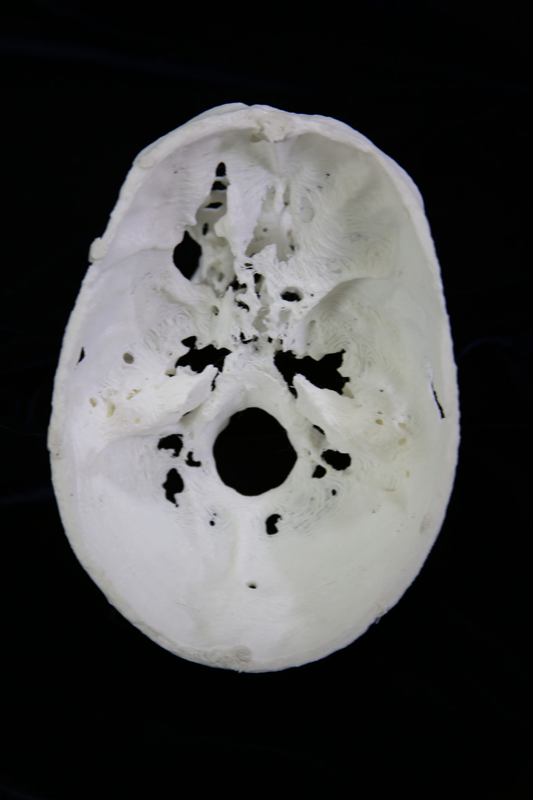 3D printed human skull model; underside view with a hole in the top