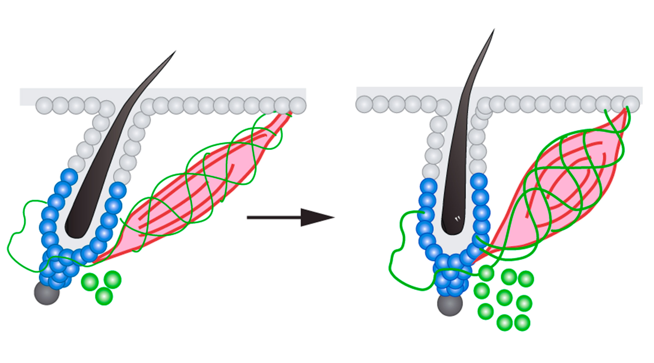 Graphic of hair follicle.