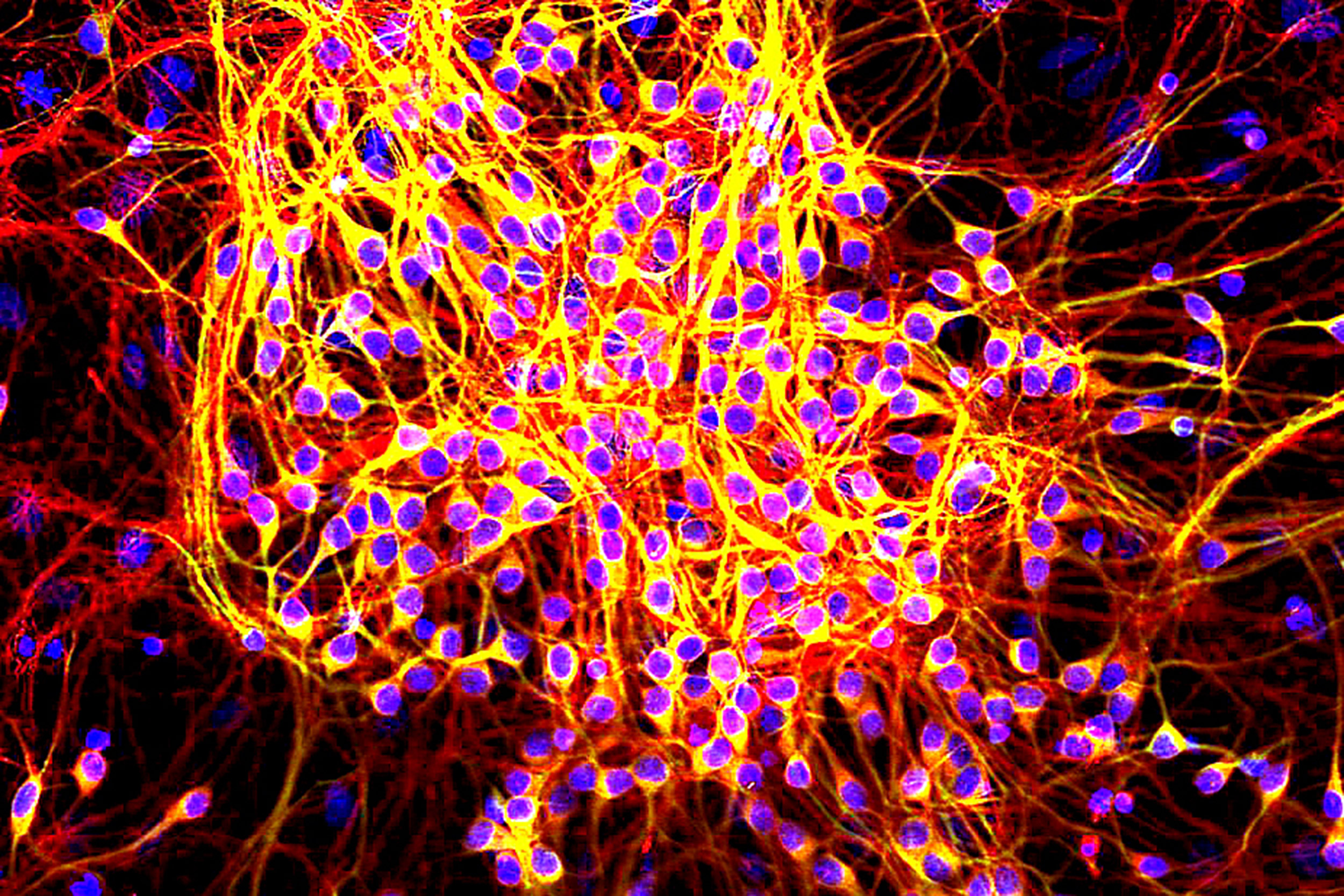 Tau proteins