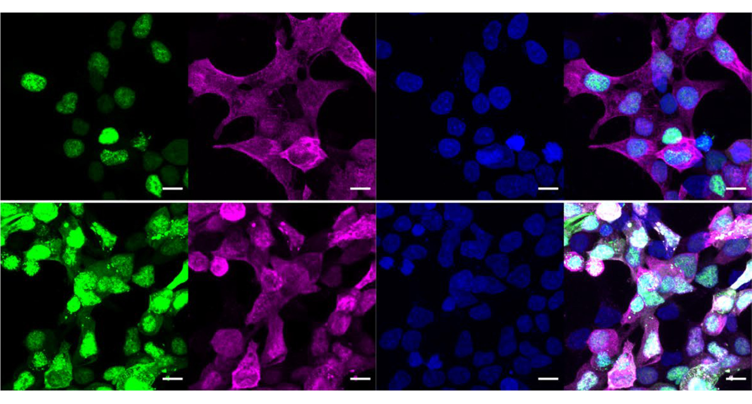 Protein imaging.