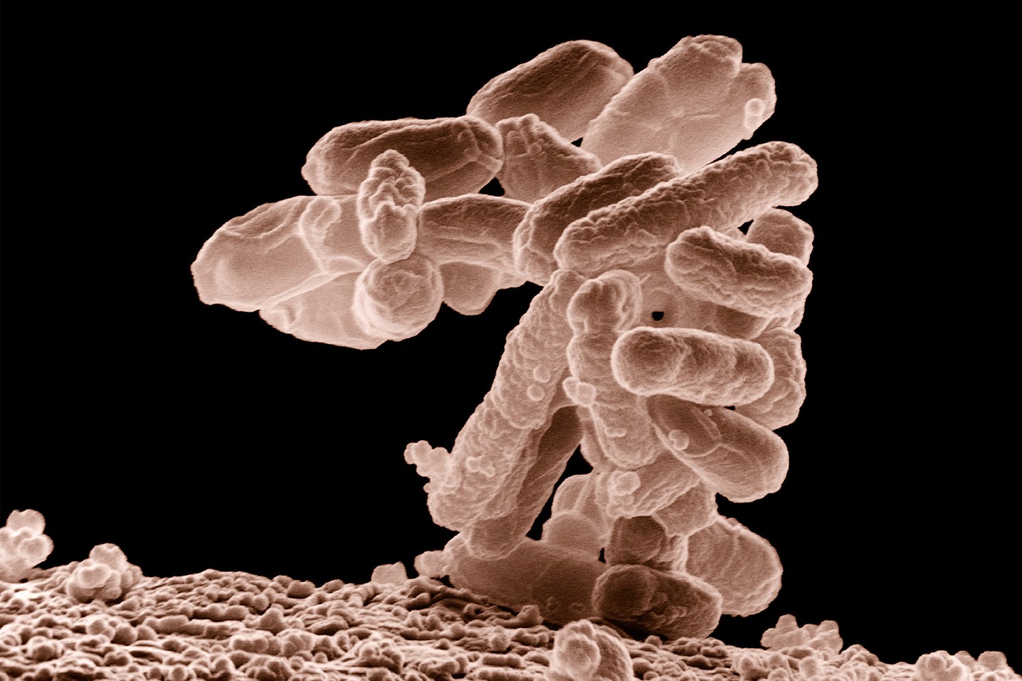 E coli