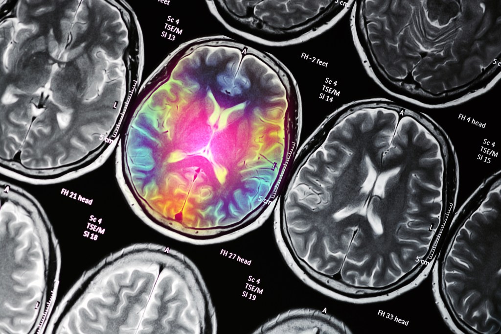 Conceptual illustration of MRI scans.