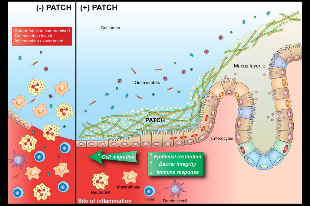 Graphic showing how bioactive material works in the intestines.