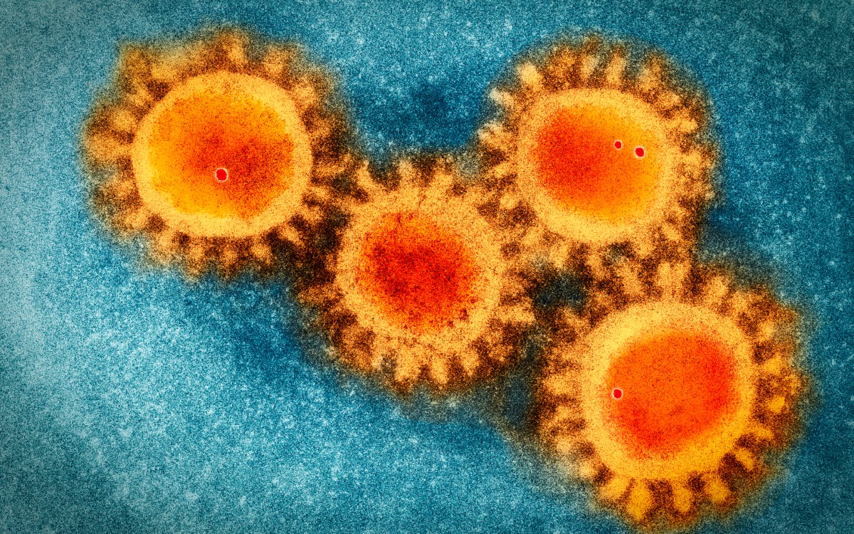 An electron microscopy photo of the coronavirus COVID-19.