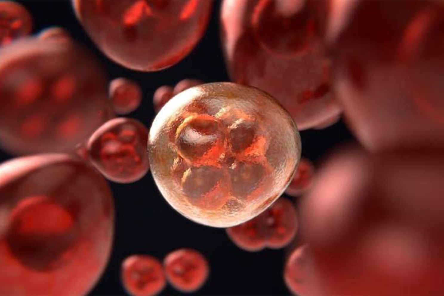 Prostate cancer cells.