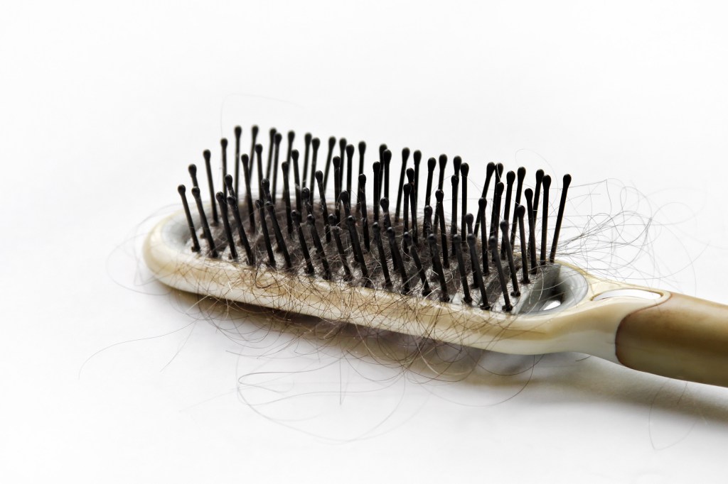 Hair loss concept of close up hairbrush and fallen hair.