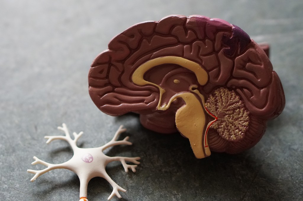 Plastic brain model.