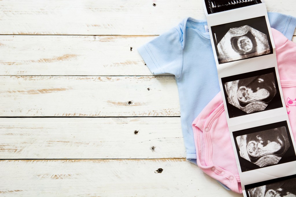 Pink and blue baby romper and ultrasound on white wooden background