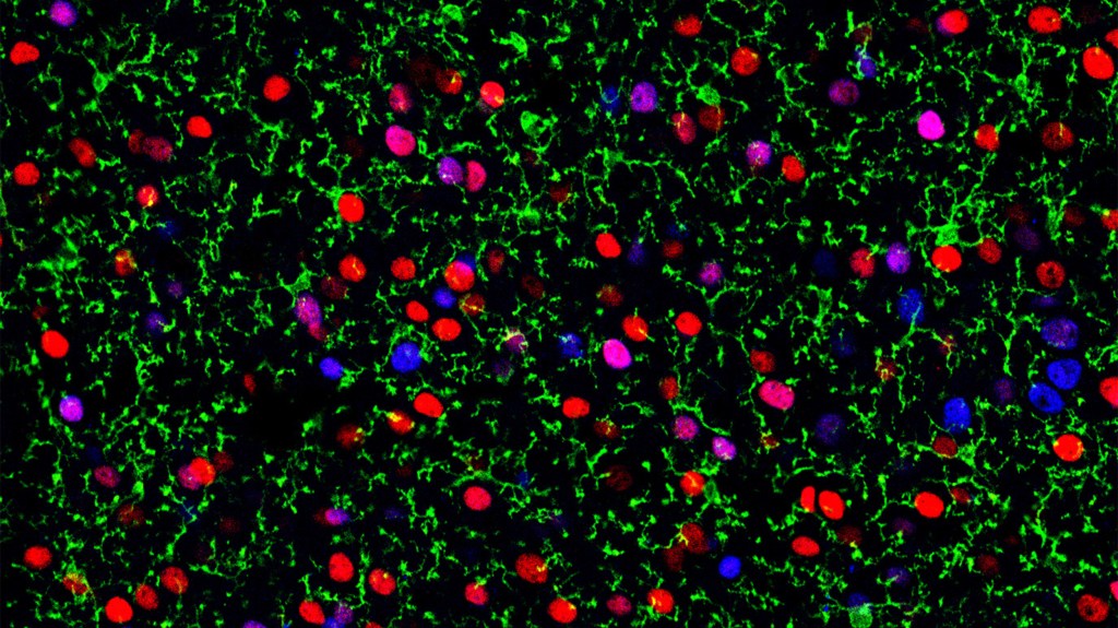 Brain and neurons.