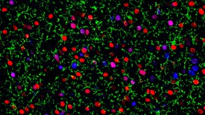 Brain and neurons.