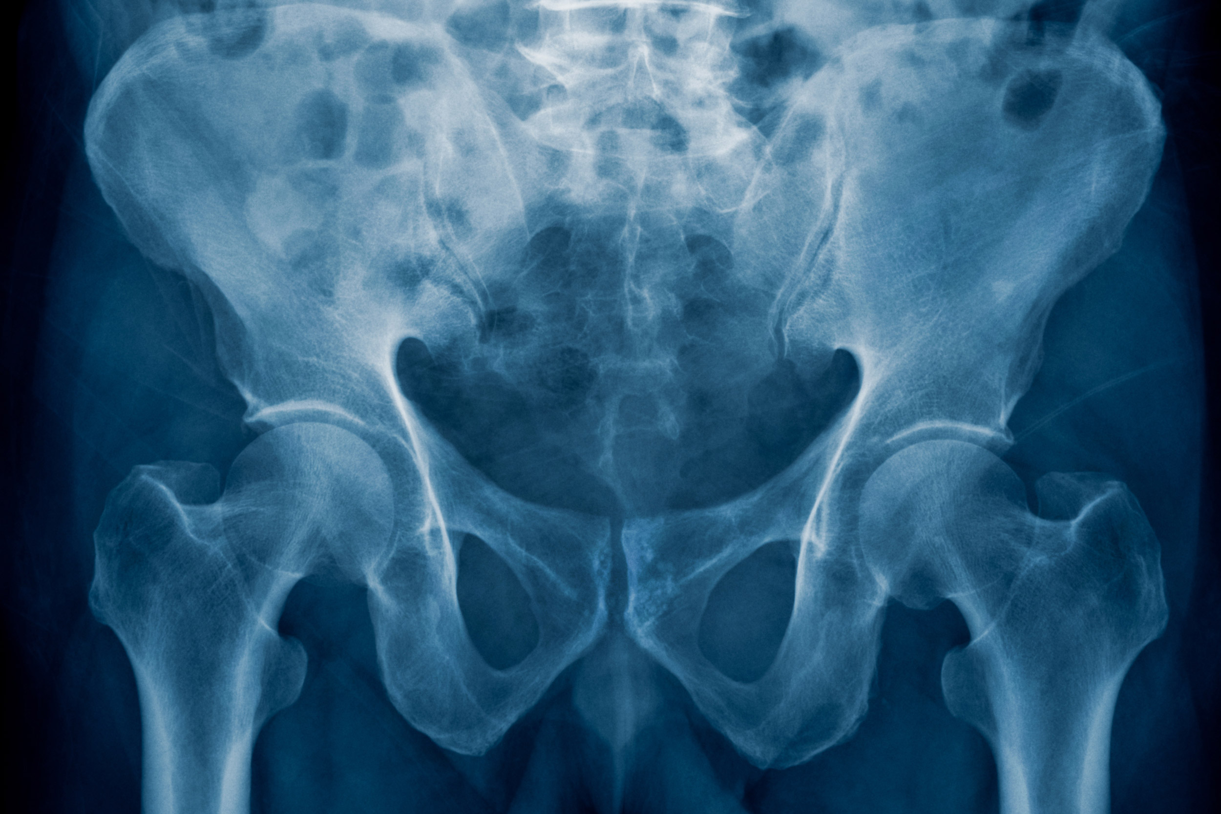 Genetic study shows evolution of human pelvis — Harvard Gazette