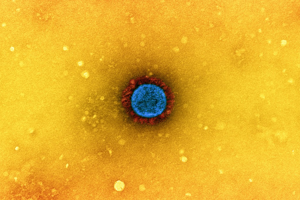 Image of the virus that causes COVID-19.