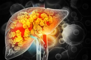 Damaged liver.