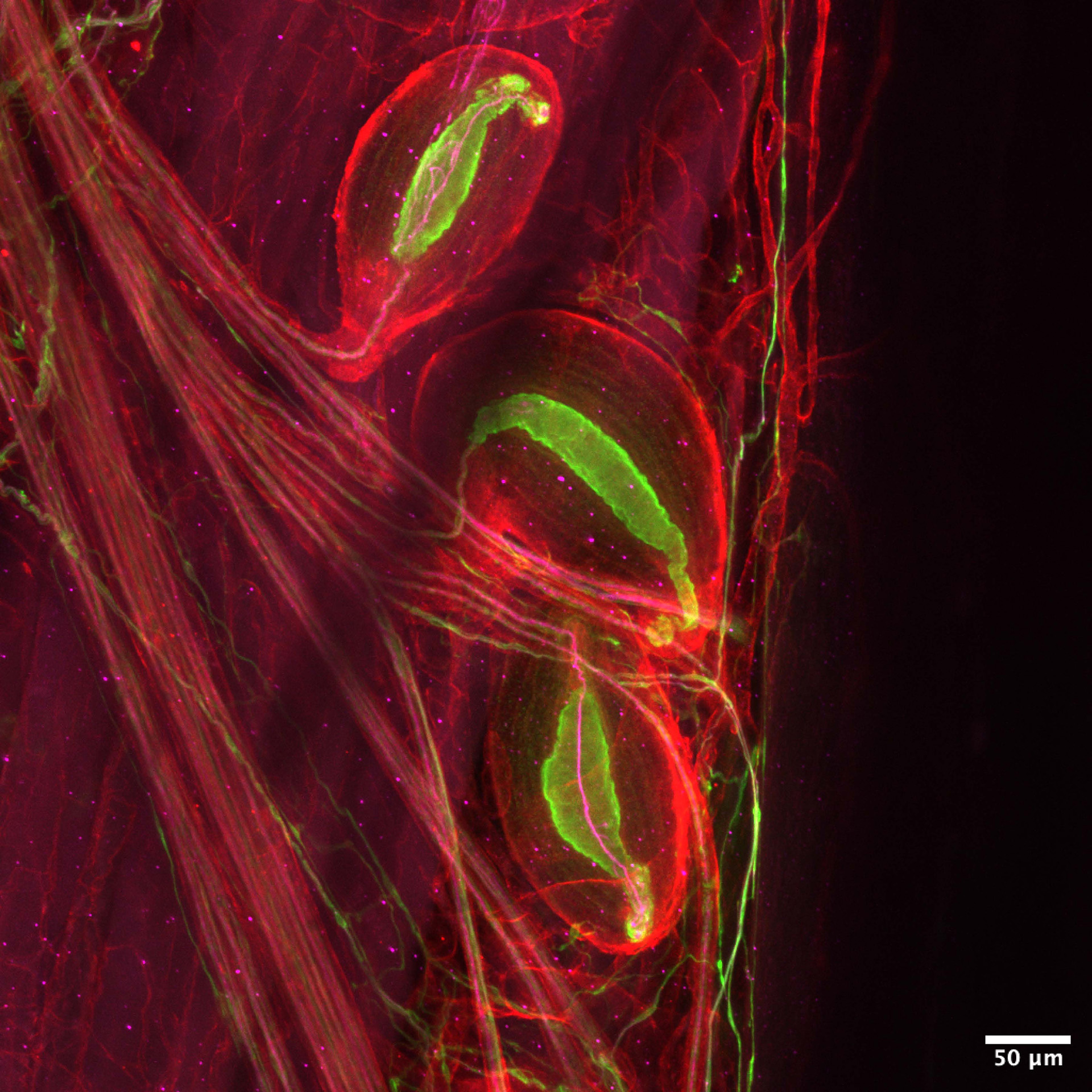 Pacinian corpuscles.