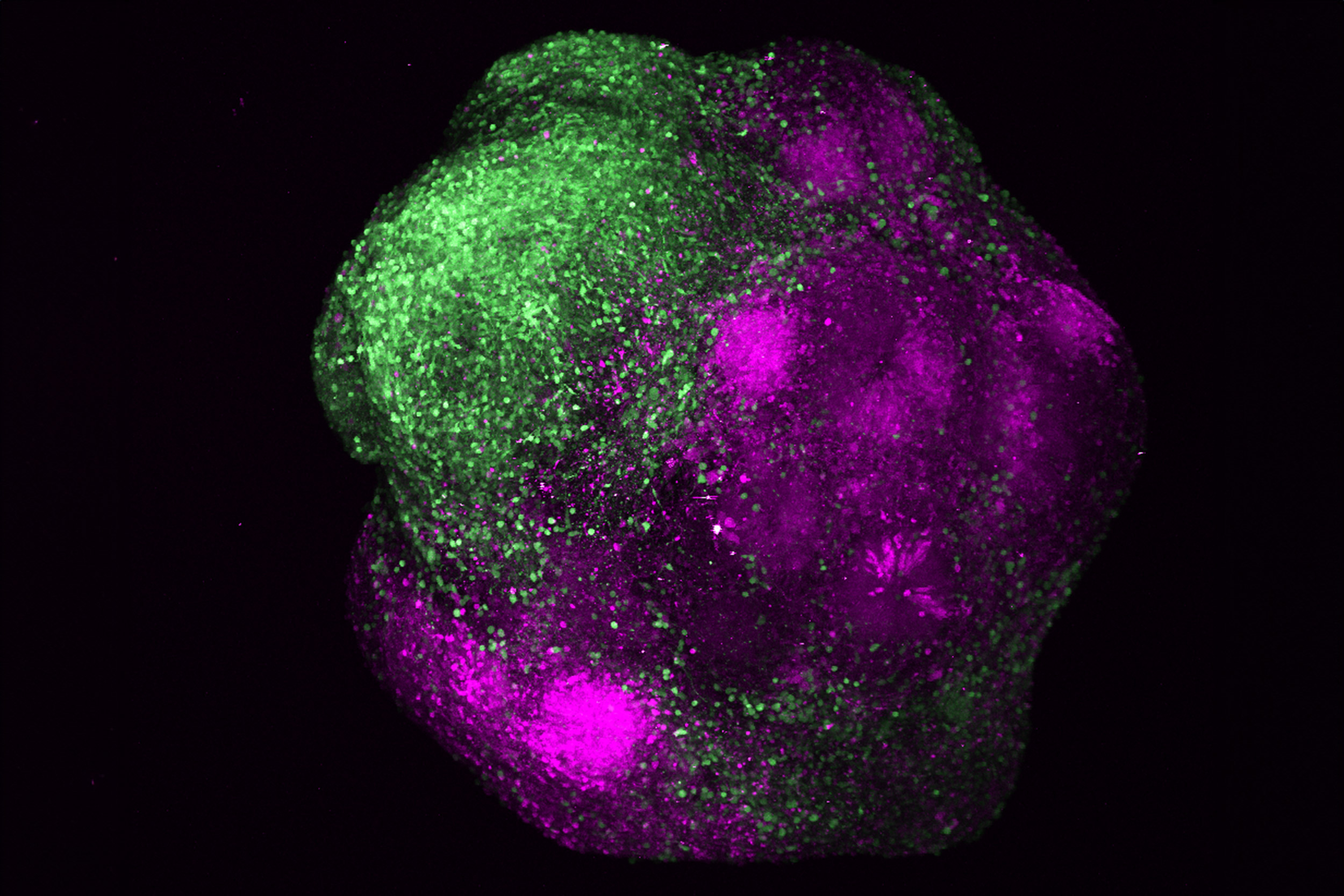 Human brain organoid showing the integration of excitatory (magenta) and inhibitory neurons (green) of the cerebral cortex.