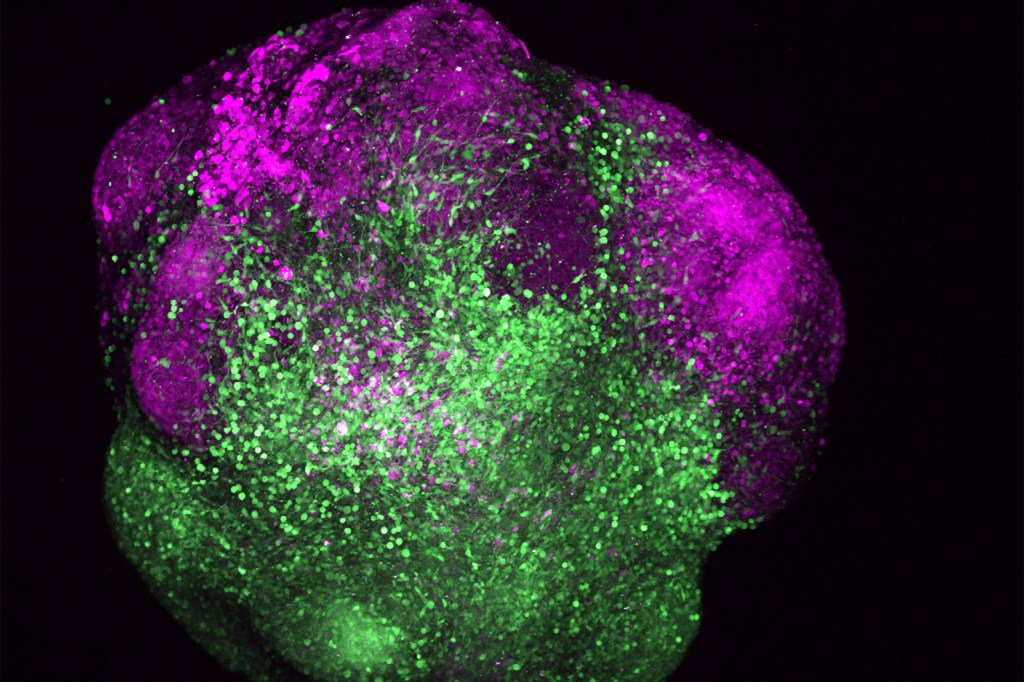 Human brain organoid