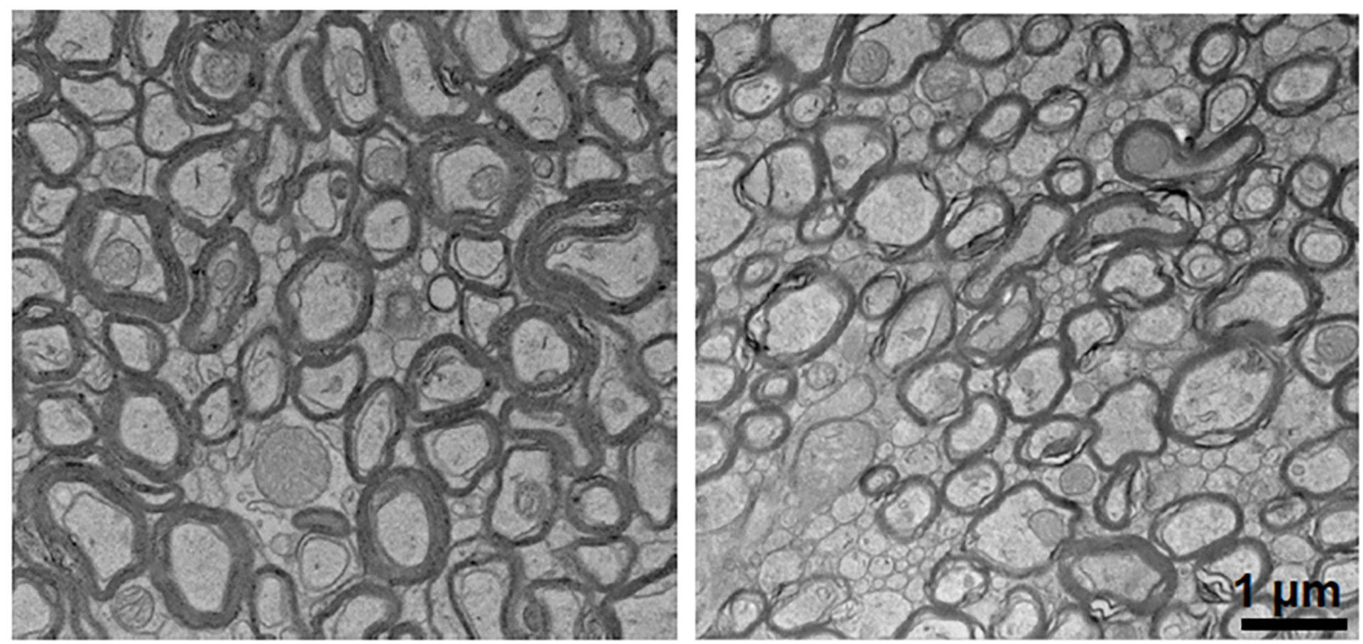 Side-by-side grayscale electron microscopy images show thicker cell borders on the left and thinner borders on the right.