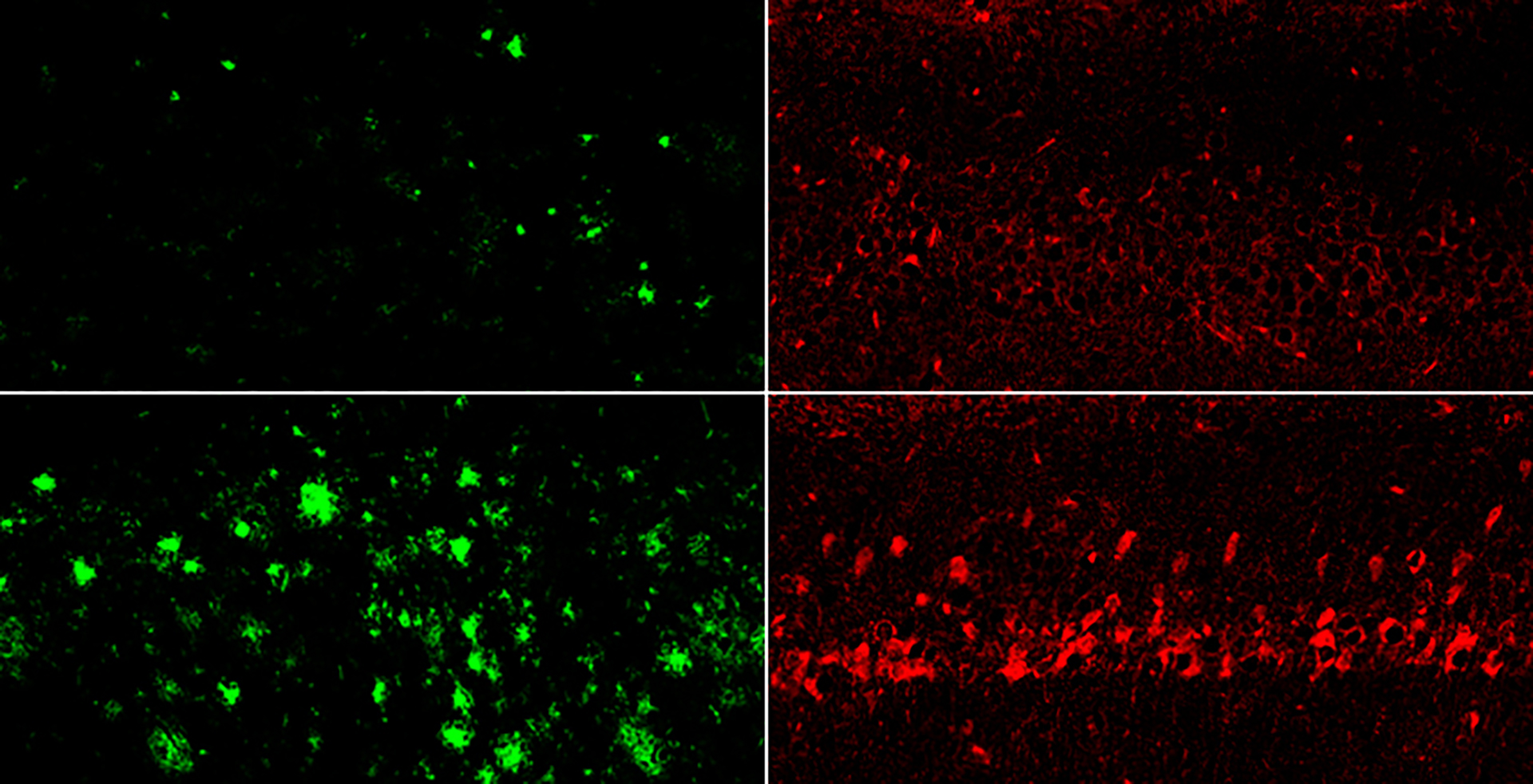 Stacked boxes on the left show significantly fewer green amyloid-beta clumps for mice treated with lithium orotate. Stacked boxes on the right show a similar drop in red tau tangles.