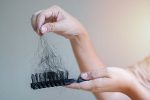Hair loss problem concept.
